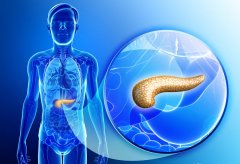 胰腺癌早期症状有哪些？身体出现这5种症状之一，别掉以轻心，要尽快检查