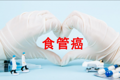 食管癌好治疗吗？得了食管癌怎么办？